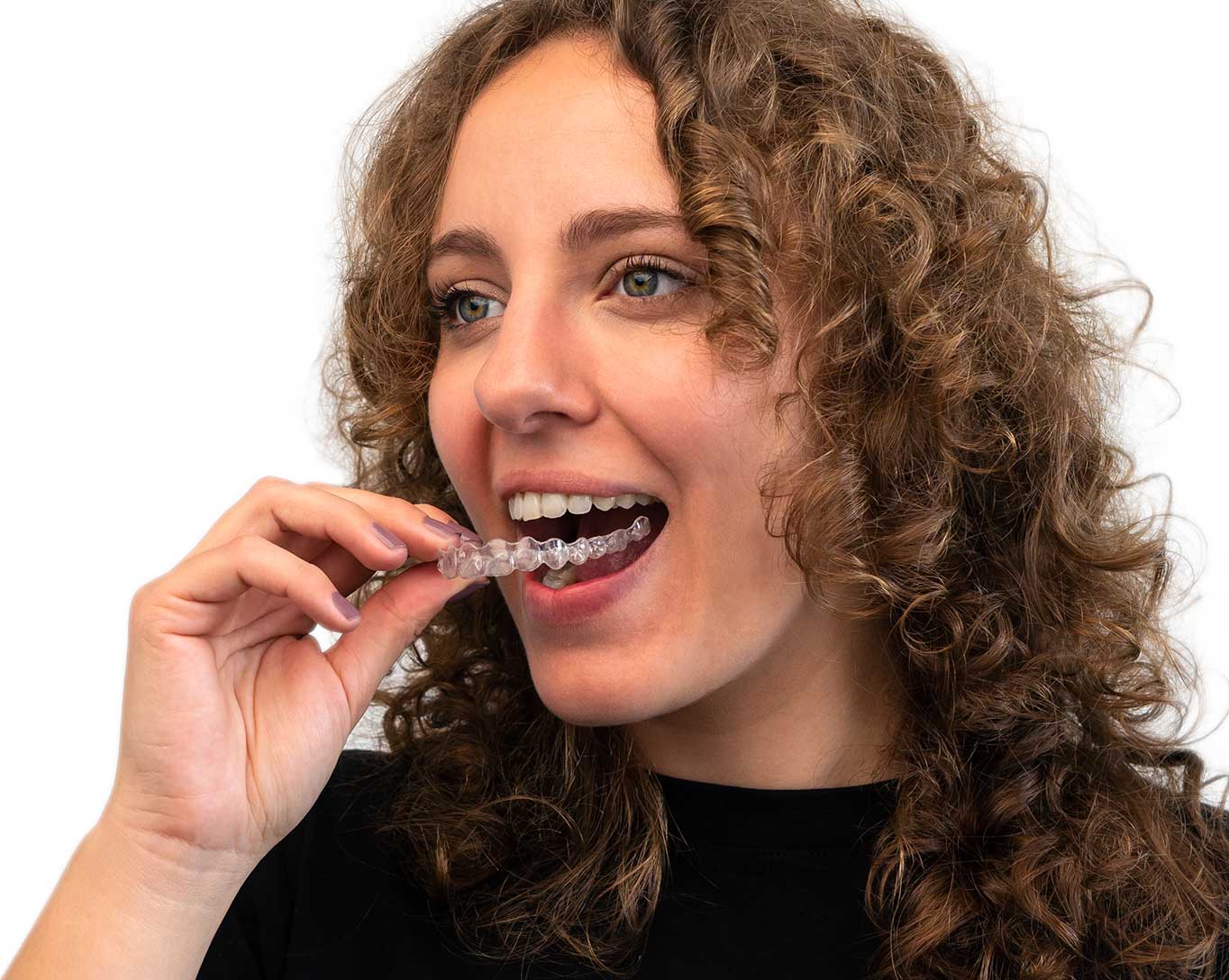 Adult-invisalign