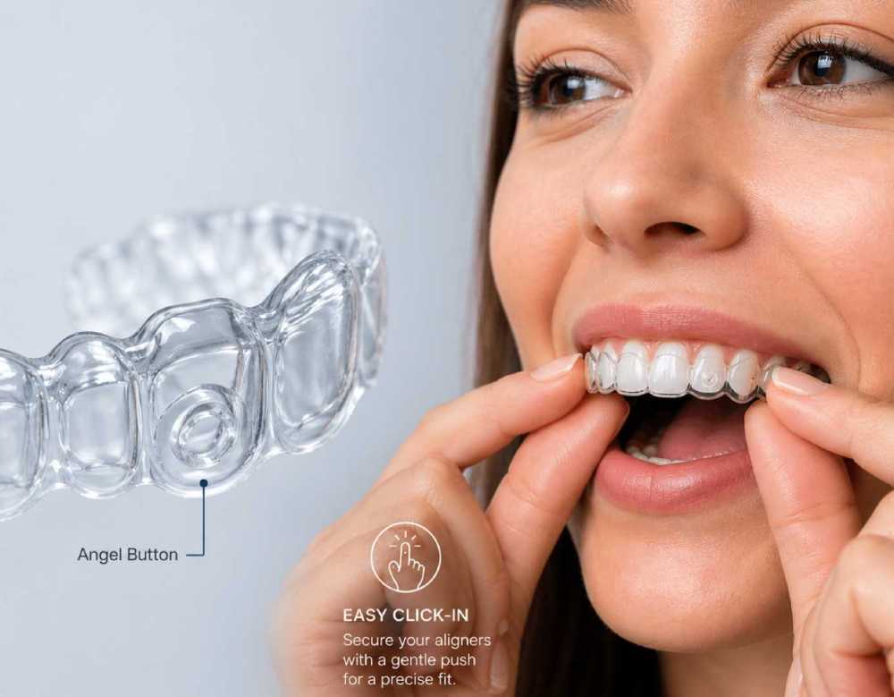 Angel aligner blog image 2026